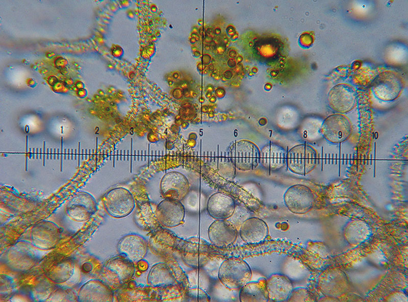 Arcyria (pomiformis ?)